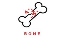 Lal Path lab noida sector 78 Bone test