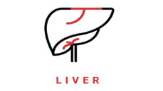 Lal Path lab noida sector 78 Liver test